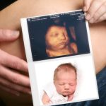 4D Colour Ultrasound