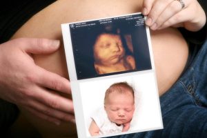 4D Colour Ultrasound