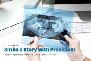 OPG Dental X-Ray Services in South Delhi