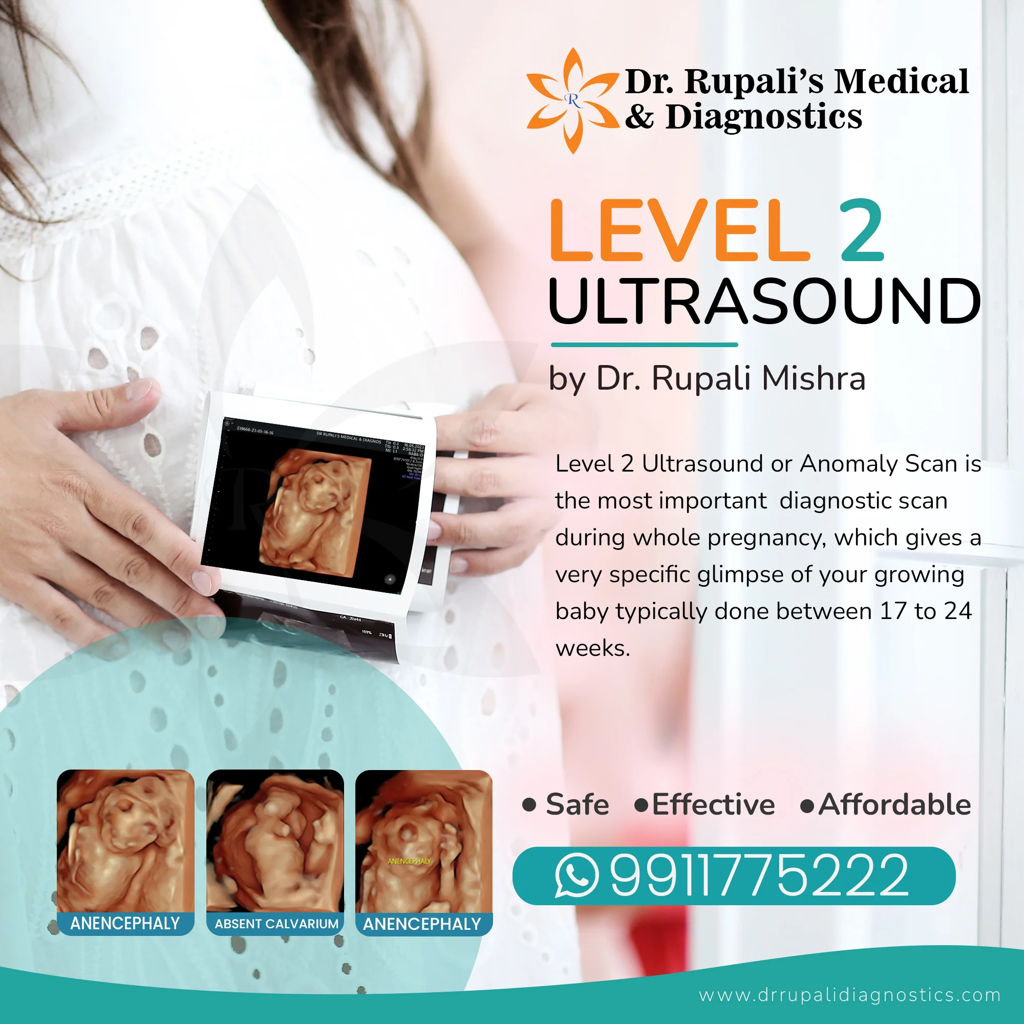 Level2 Ultrasound in South Delhi