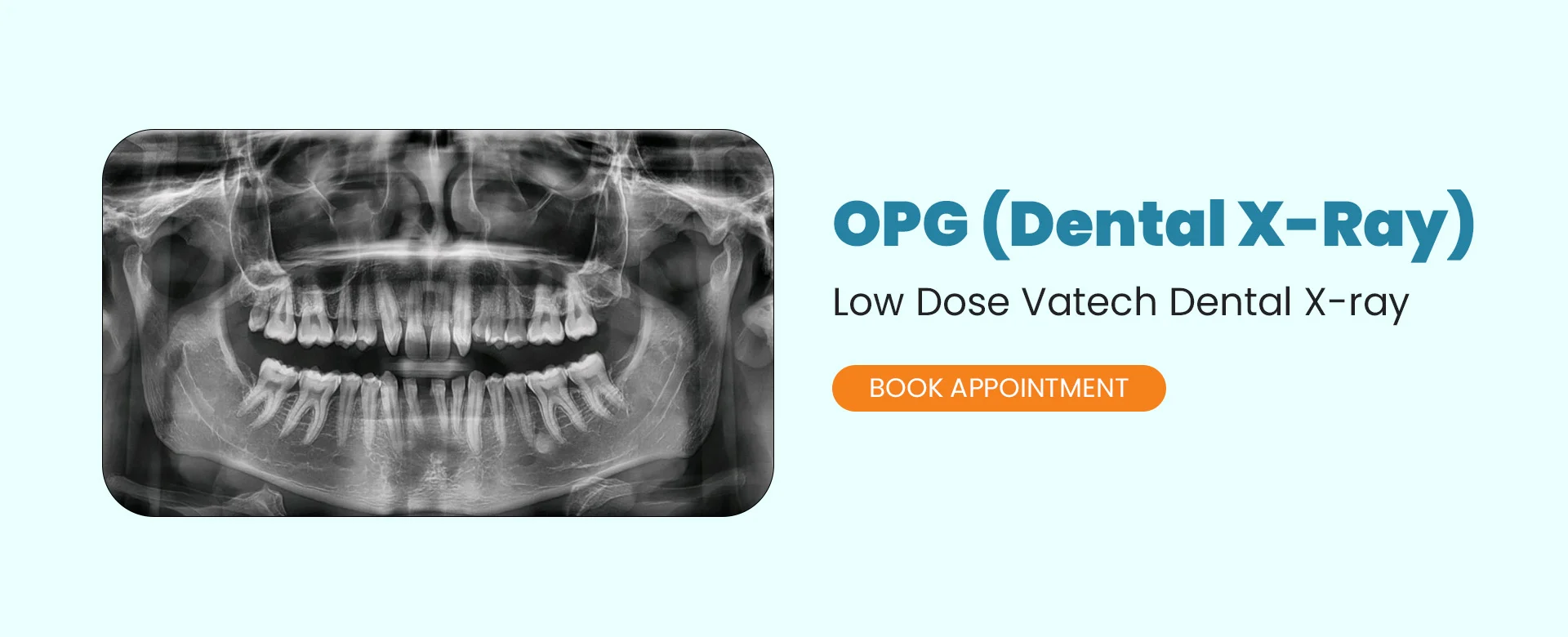 Dental X-Ray in South Delhi