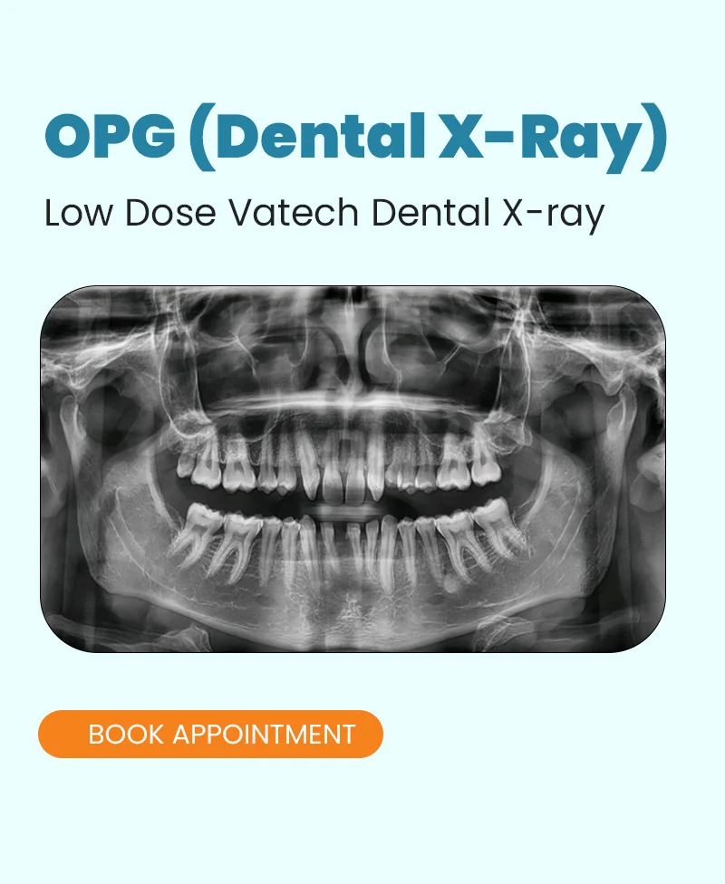 Dental X-Ray in South Delhi
