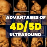 Advantages of 4D or 5D Ultrasound in Faridabad