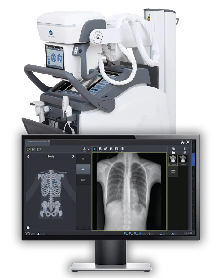 Digital X-ray at Home Professional